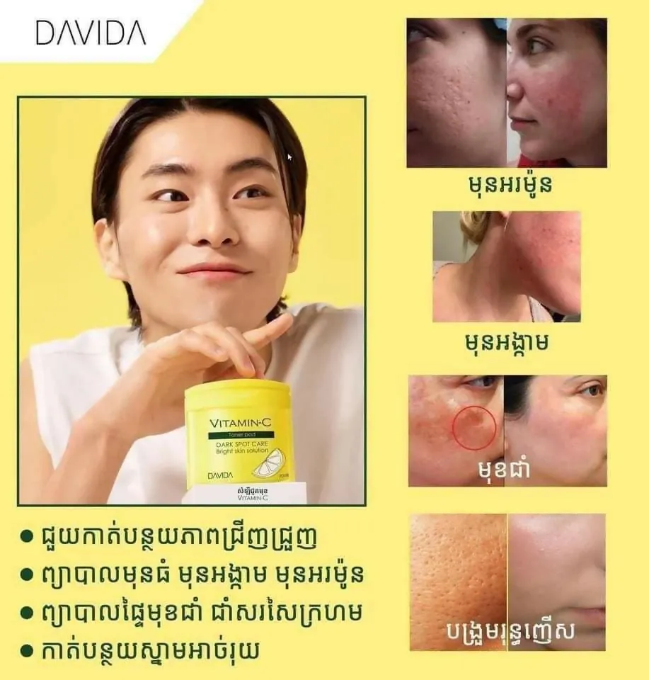 Davida vitamin-c toner pad