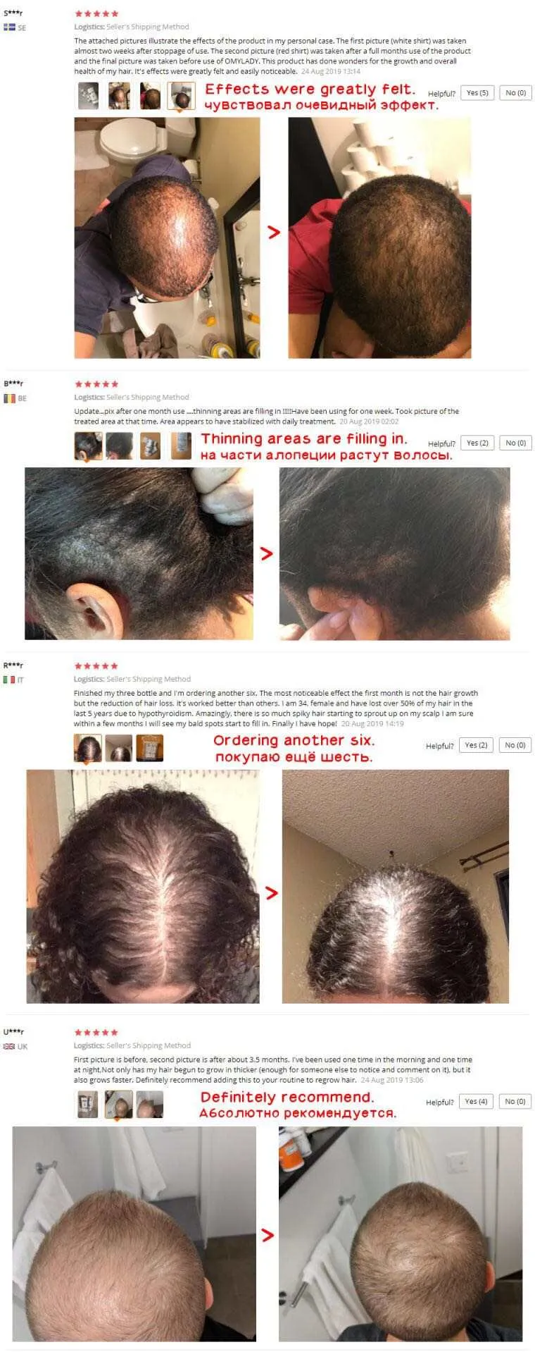 NEW Biotin Hair Growth Spray - Organic Serum for Thicker, Healthier Hair | Best Selling