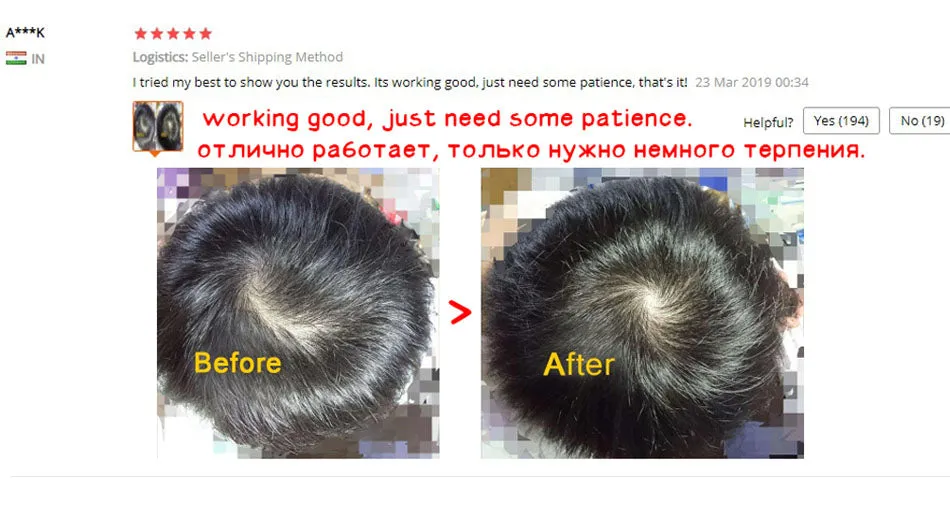 NEW Biotin Hair Growth Spray - Organic Serum for Thicker, Healthier Hair | Best Selling